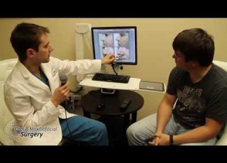 Scarless Mole Removal Techniques With Ellman Radiowave Surgery