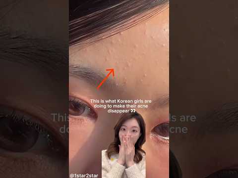 How Korean Girls Remove Acne Tiny Pimples Whiteheads Shorts How Korean Girls Remove Acne Tiny Pimples Whiteheads Shorts