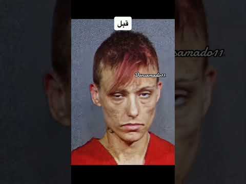 اشكال أشخاص قبل وبعد تخلصهم من ادمان المخدرات