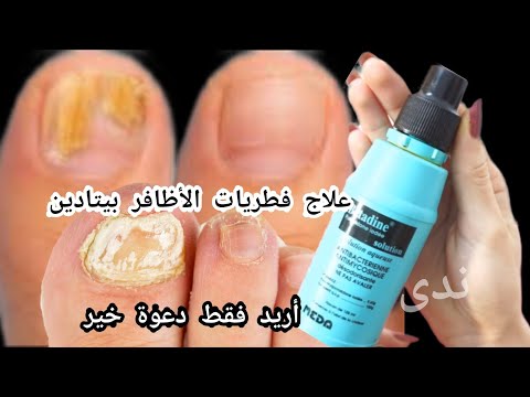 بقرعة بيتادين علاج فطريات الأظافر والكزيما للأبد وصفة تغنيك عن طبيب مجربة أريد فقط دعوة خير