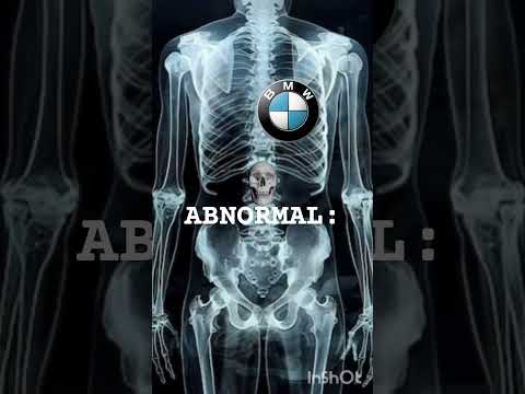 ARE YOU ALSO ABNORMAL Abnormal