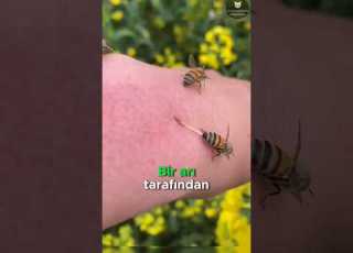  Arı Soktuğunda Ne Yapmalısınız