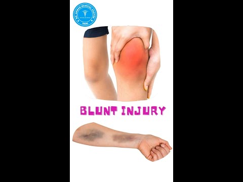 ग म च ट लगन पर स क ई क सस कर Shorts Shortvideo Viralvideo Ytshortsindia Shortsfeed