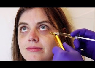 تعرف علي افضل 3 طرق لعلاج الهالات السوداء تحت العين The Best 3 Ways To Treat Dark Circles ASMR