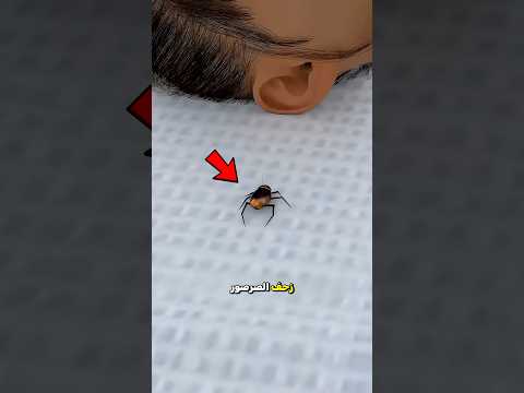 لم تشعر حتى دخل الصرصور الى أذنها