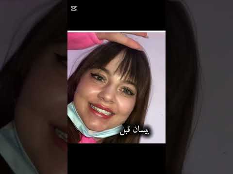 مين احلى قبل وبعد نارين بيوتي قمر طائي بيسان اسماعيل لين محمد ساره الورع لانا محمد