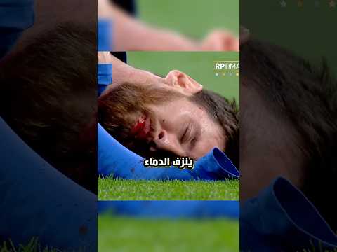 في البيرنابيو نزف ميسي دم ا ثم جعل مدريد تنزف صمت ا ميسي برشلونة ريال مدريد Messi