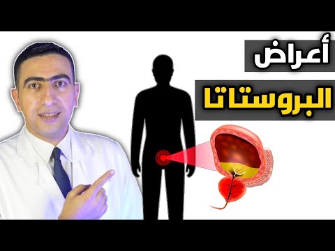 اعراض التهاب وتضخم البروستاتا أسباب كثرة التبول وحرقان البول