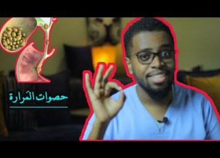  حصوات المرارة ما أسبابها وكيف تعالجها في المنزل قبل استئصالها Gallstones
