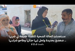 مستجدات الحالة الصحية للطفلة خديجة لي ضربها صعصع بحديدة وتحل ليها حنكها وطاحو ضراسها