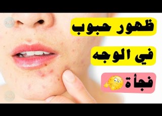  سبب ظهور حبوب في الوجه فجأة