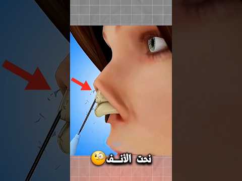 عمليه تجميل الأنف المحدبة Shorts