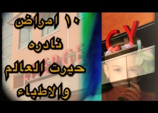  ١٠ امراض نادرة وغربية حيرت الاطباء والعالم