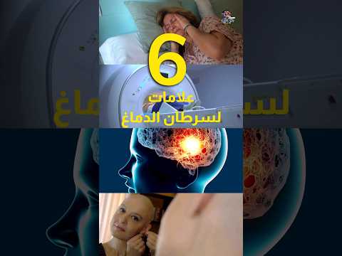 Shorts اعراض سرطان الدماغ اهلا يا دكتور استشارة طبية هاطمنك