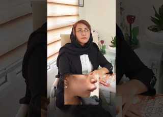 تزریق خوشگل ترین ژل های لب فیلر فیلر لب ژل لب تزریق زیبایی مدلینگ کلیپ طنز طنز فان