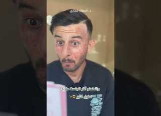  طريقة التخلص من النمش بسرعة