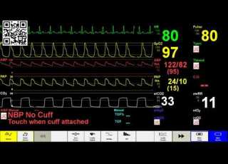  Timed Simulated Patient ICU Monitor