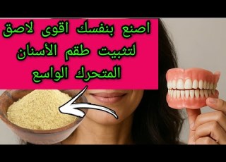  كيفية عمل أقوى لاصق منزلي لتثبيت طقم الأسنان المتحرك الكامل أو الجزئي بقوة في الفم من مواد طبيعية