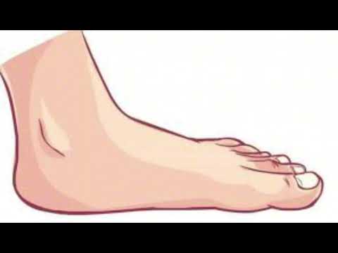 بینینی قاچ لە خەوندا