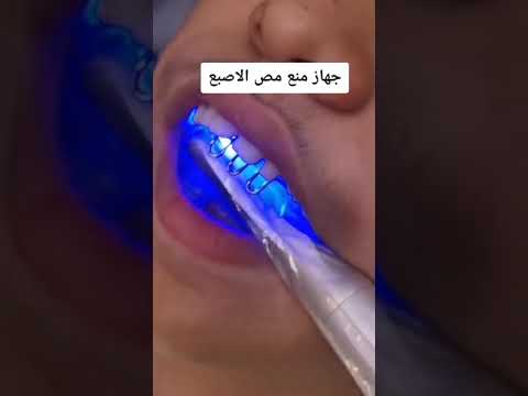 جهاز منع مص الاصابع