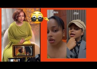 Reaction To NANDY S LIPS SURG RY AFTER THE ALLEGED BBL MONTHS AGO