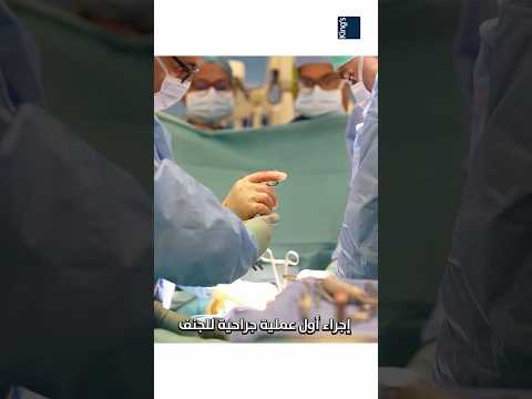 اعوجاج العمود الفقري مش مجرد مشكلة في الشكل ده مرض حقيقي