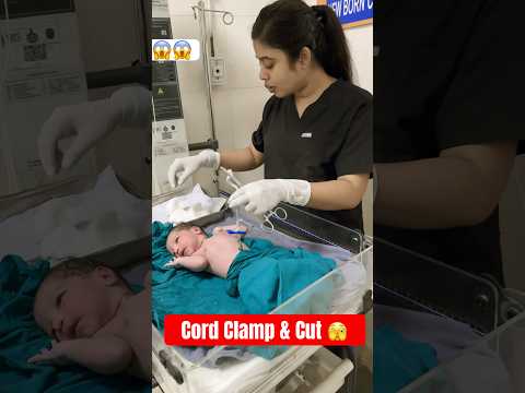 Cord Clamp And Cut Shorts Viral Newborn