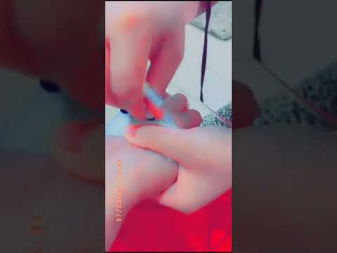 ستوريات بنات حزينه كيوت كانونه ايد بنت مريضه بالمستشفى مقاطع حزينه