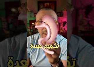 ربط المعدة