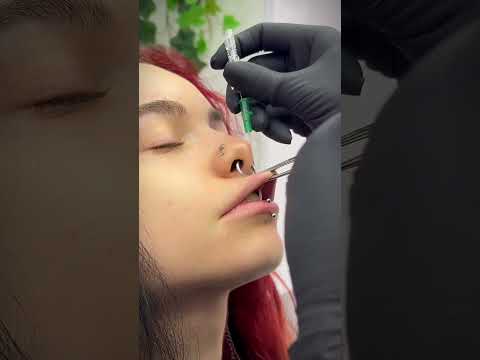 This Is A Medusa Lip Piercing