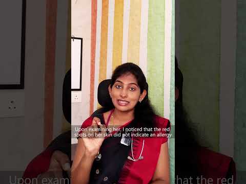 உங க Skin Rashes க க கண ட ப ப இந த Tablet எட த த க க த ங க