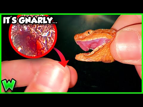 What Happens If A Copperhead BITES You