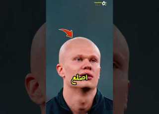  هل Erling Haaland أصلع فعلا