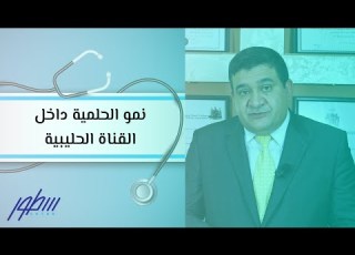  نمو الحلمية داخل القناة الحليبية