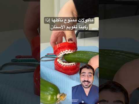 مأكولات ممنوع نأكلها إذا ركبنا تقويم الأسنان Dentalsecrets الشعب الصيني ماله حل ترند طفلي