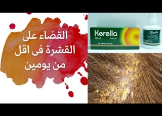  تجربة الناس لاستخدام الكيريلا لوشن لقشرة الشعر صدمة ب ١٤ جنيه فقط لعلاج القشرة فى يومين