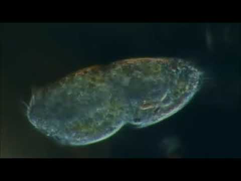 فيديو يوضح كيف يتم التكاثر اللاجنسي ف الاميبا الانشطار الثنائي فيديو يوضح كيف يتم التكاثر اللاجنسي ف الاميبا الانشطار الثنائي