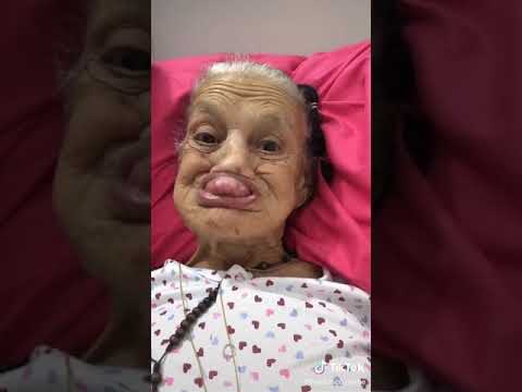 عجوز مسكينه ماعدها اسنان