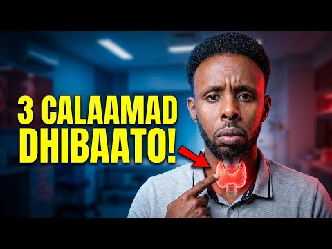 3 Calaamad In Qanjirka Thyroid Kaagu Halis Ku Jiro Ha Iloobin Midda 2 Aad