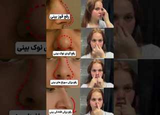 با این روش مشکلات بینیت رو رفع کن دماغ بینی جراحی بینی عمل بینی ترند جراحی زیبایی Viral