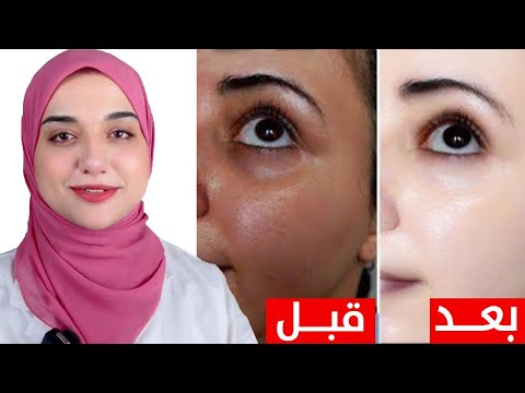 سر تفتيح البشرة و ازالة التصبغات بمنتج اقتصادي و رخيص جدا