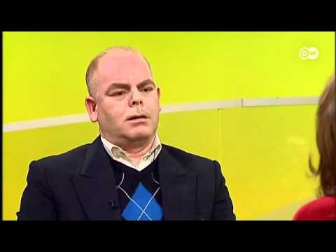 أعراض وأنواع وسواس توهم المرض صحتك بين يديك