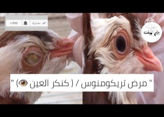  مرض التريكومنوس كنكر العين