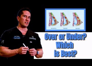 Breast Implants Over Or Under Which Is Best