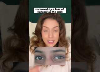 Listen If You Have Under Eye Hollowness Shortsvideo Skincare Skincaretips
