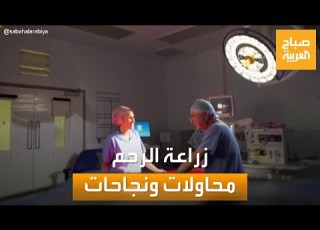 صباح العربية حلم الأمومة بزراعة الرحم محاولات عدة ونجاحات متتالية