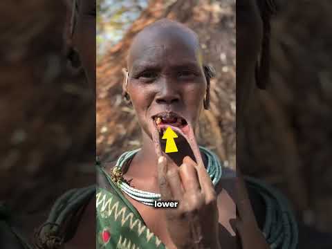 How Far Would You Go For Beauty