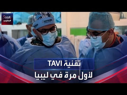 تقنية TAVI لأول مرة في ليبيا