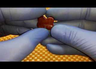 هدا هوى الحجر الكبدي الاصليThis Is The Original Hepatic Stone