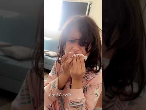 طريقة خلع الاسنان عند الاطفال